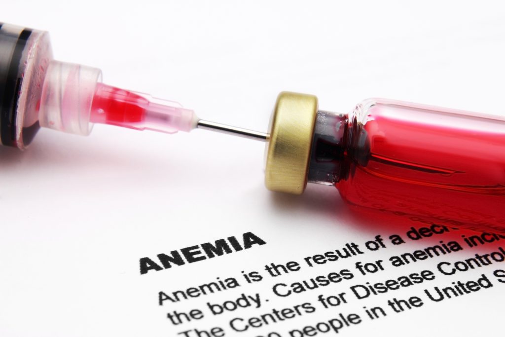 Can I Qualify for Disability Benefits with a Blood Disease? Anemia 1024x683 - Can I Qualify for Disability Benefits with a Blood Disease?