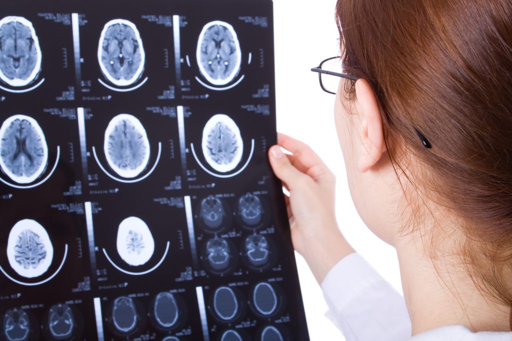 Can I Qualify for Disability Benefits with a Neurological Disorder in Pennsylvania? Brain Scans 1024x683 - Can I Qualify for Disability Benefits with a Neurological Disorder in Pennsylvania?