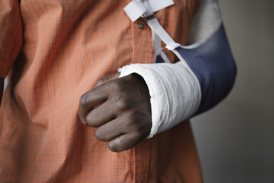 broken arm broken arm