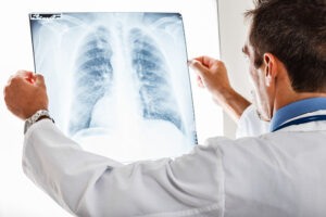 Chest-X-Ray